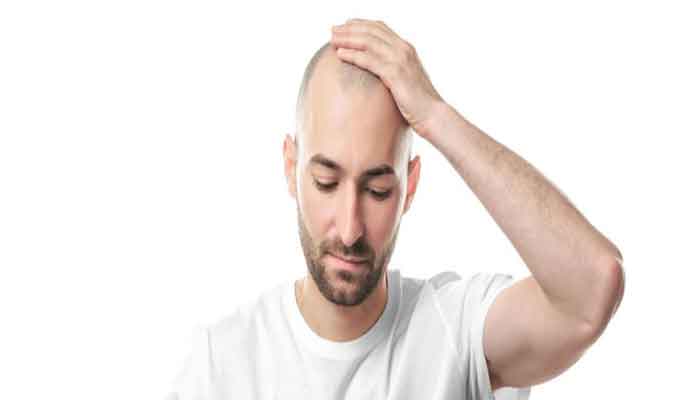 کاشت مو با بانک موی دیگران: خطرناک و غیر ضروری