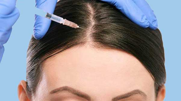   مزوتراپی مو چیست؟