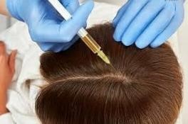 فواید مزوتراپی مو چیست؟