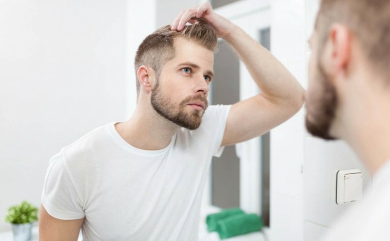 چند دلیل  ریزش موی مردان