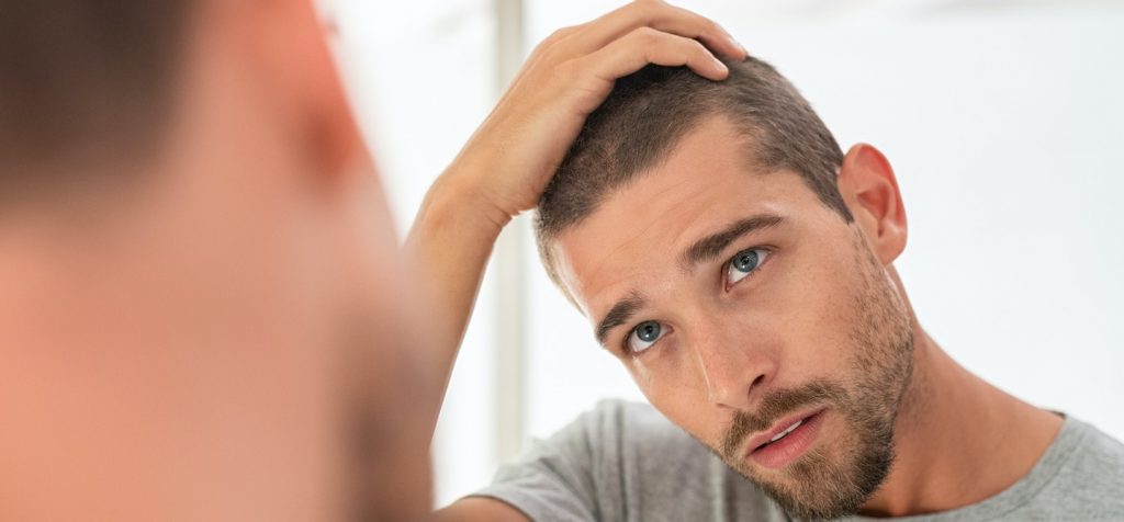 روش های درمانی برای ریزش مو در آقایان