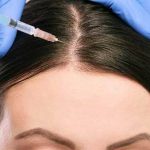   مزوتراپی مو چیست؟